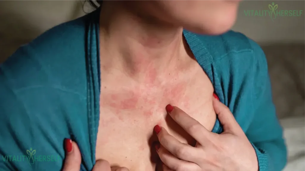 Understanding Interdigital Eczema and its Underlying Causes