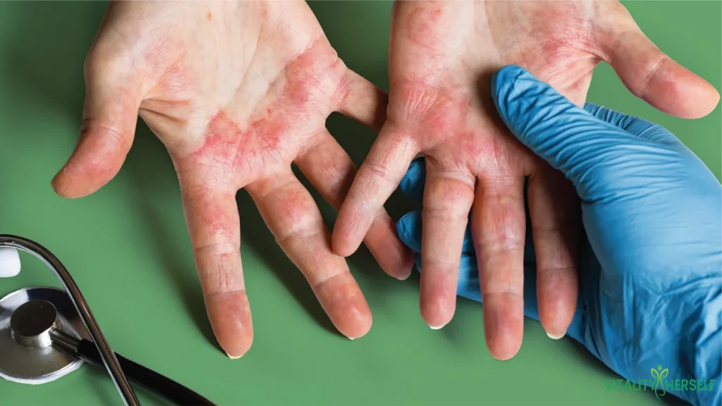 What Causes Fungus on Skin Between Toes and How to Treat It?